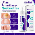 Medinail - Spray Antifúngico - Dile adiós a los hongos y malos olores.