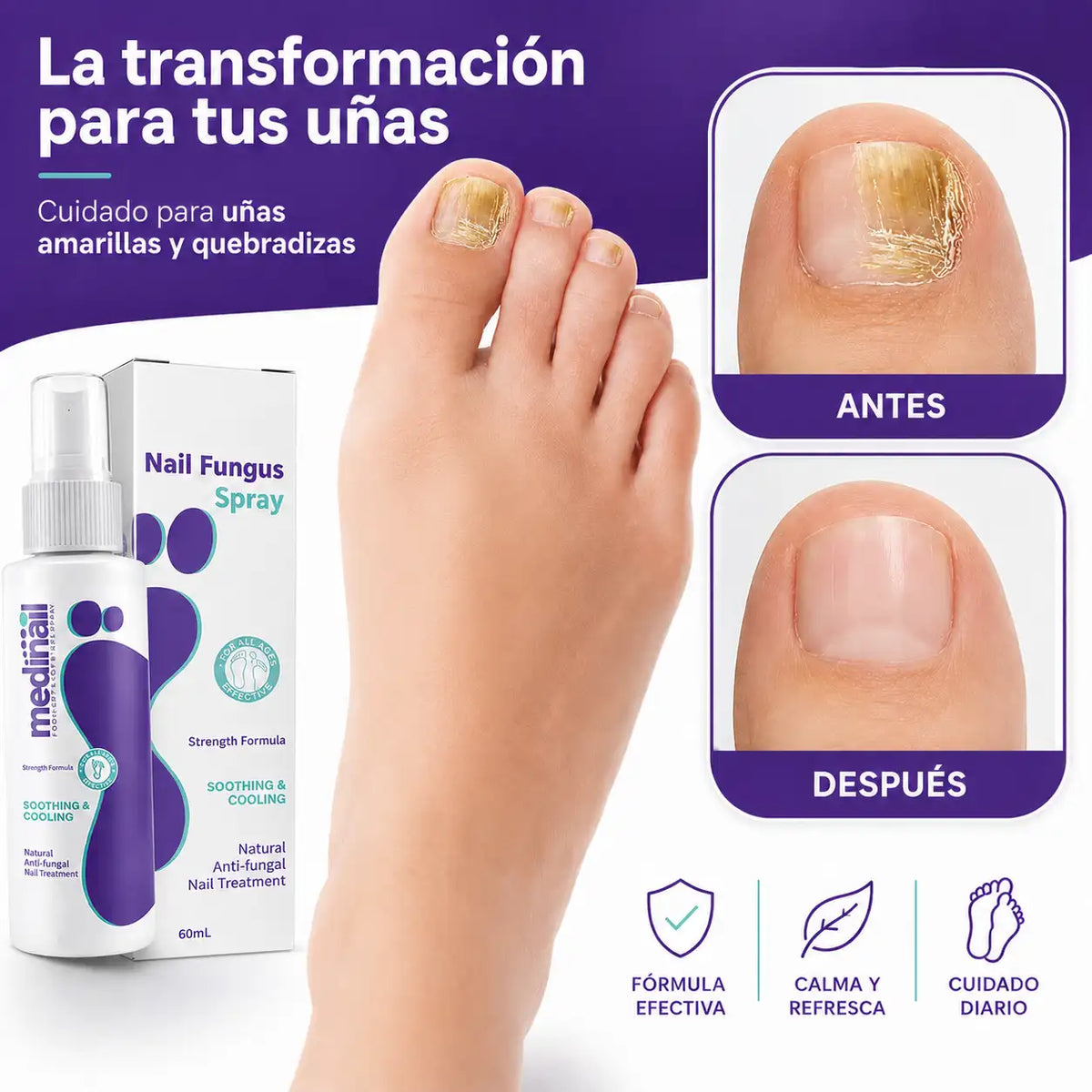 Medinail - Spray Antifúngico - Dile adiós a los hongos y malos olores.